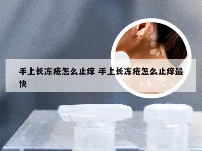 手上长冻疮怎么止痒 手上长冻疮怎么止痒最快