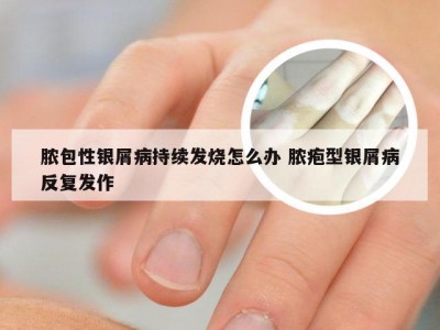 脓包性银屑病持续发烧怎么办 脓疱型银屑病反复发作