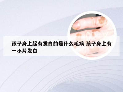 孩子身上起有发白的是什么毛病 孩子身上有一小片发白