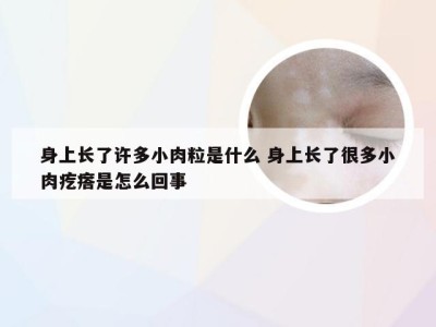 身上长了许多小肉粒是什么 身上长了很多小肉疙瘩是怎么回事