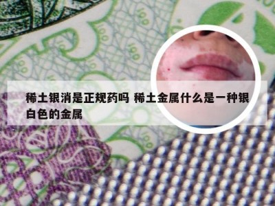 稀土银消是正规药吗 稀土金属什么是一种银白色的金属