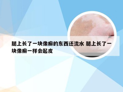 腿上长了一块像癣的东西还流水 腿上长了一块像癣一样会起皮