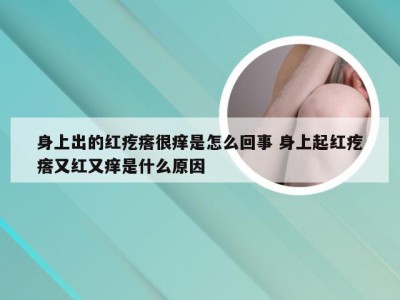 身上出的红疙瘩很痒是怎么回事 身上起红疙瘩又红又痒是什么原因