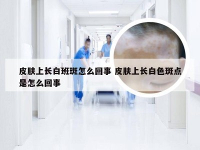 皮肤上长白班斑怎么回事 皮肤上长白色斑点是怎么回事