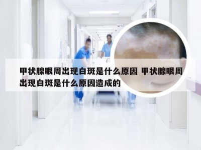 甲状腺眼周出现白斑是什么原因 甲状腺眼周出现白斑是什么原因造成的