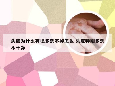 头皮为什么有很多洗不掉怎么 头皮特别多洗不干净