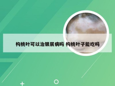 构桃叶可以治银屑病吗 构桃叶子能吃吗