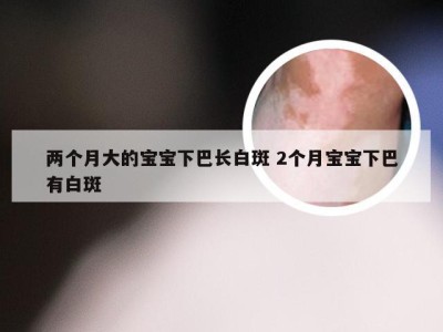 两个月大的宝宝下巴长白斑 2个月宝宝下巴有白斑