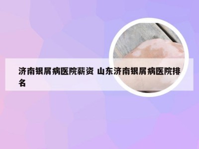 济南银屑病医院薪资 山东济南银屑病医院排名