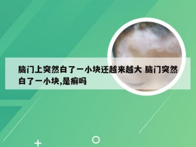 脑门上突然白了一小块还越来越大 脑门突然白了一小块,是癣吗