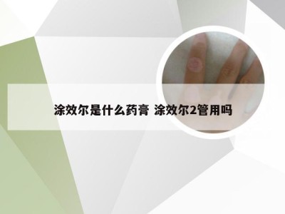 涂效尔是什么药膏 涂效尔2管用吗