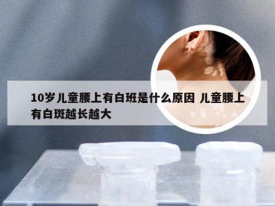 10岁儿童腰上有白班是什么原因 儿童腰上有白斑越长越大