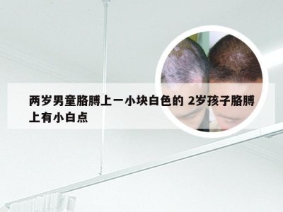 两岁男童胳膊上一小块白色的 2岁孩子胳膊上有小白点