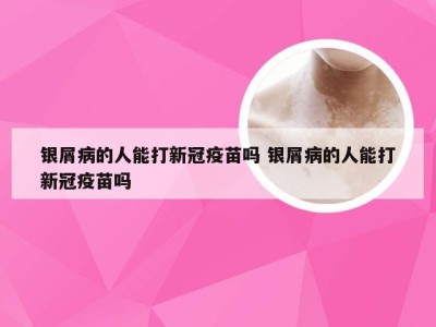 银屑病的人能打新冠疫苗吗 银屑病的人能打新冠疫苗吗