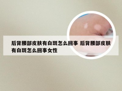 后背腰部皮肤有白斑怎么回事 后背腰部皮肤有白斑怎么回事女性