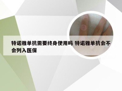 特诺雅单抗需要终身使用吗 特诺雅单抗会不会列入医保