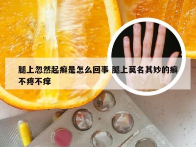 腿上忽然起癣是怎么回事 腿上莫名其妙的癣不疼不痒