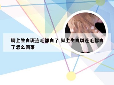 脚上生白斑连毛都白了 脚上生白斑连毛都白了怎么回事