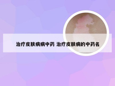 治疗皮肤病病中药 治疗皮肤病的中药名