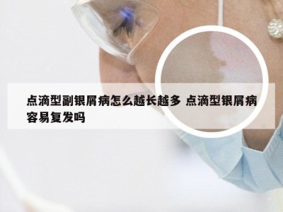 点滴型副银屑病怎么越长越多 点滴型银屑病容易复发吗