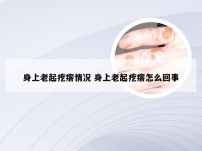 身上老起疙瘩情况 身上老起疙瘩怎么回事