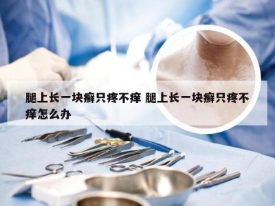 腿上长一块癣只疼不痒 腿上长一块癣只疼不痒怎么办