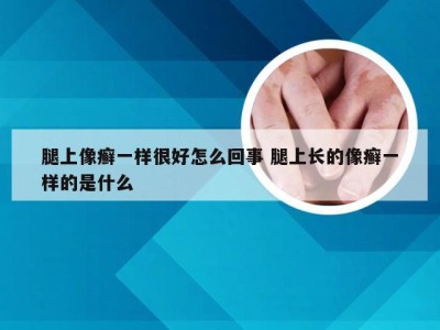 腿上像癣一样很好怎么回事 腿上长的像癣一样的是什么