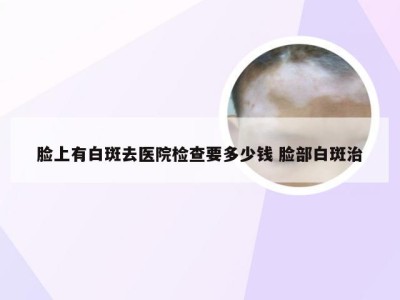 脸上有白斑去医院检查要多少钱 脸部白斑治