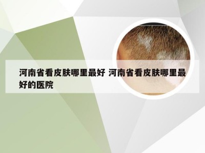 河南省看皮肤哪里最好 河南省看皮肤哪里最好的医院