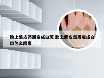 脸上起皮然后变成白斑 脸上起皮然后变成白斑怎么回事