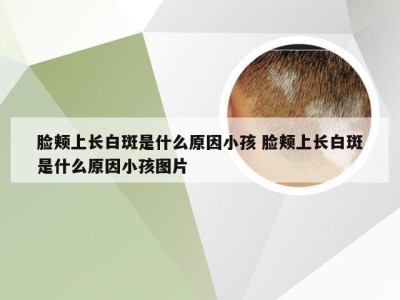 脸颊上长白斑是什么原因小孩 脸颊上长白斑是什么原因小孩图片