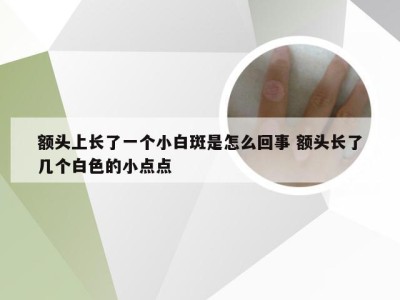 额头上长了一个小白斑是怎么回事 额头长了几个白色的小点点