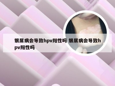 银屑病会导致hpv阳性吗 银屑病会导致hpv阳性吗