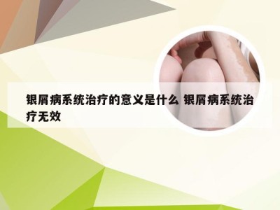 银屑病系统治疗的意义是什么 银屑病系统治疗无效