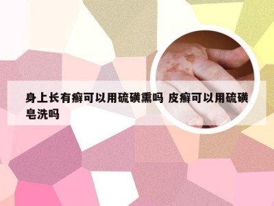 身上长有癣可以用硫磺熏吗 皮癣可以用硫磺皂洗吗