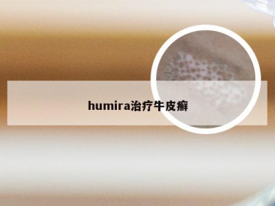 humira治疗牛皮癣