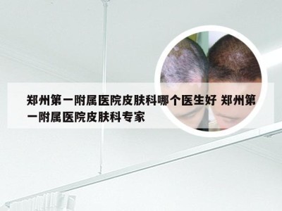 郑州第一附属医院皮肤科哪个医生好 郑州第一附属医院皮肤科专家