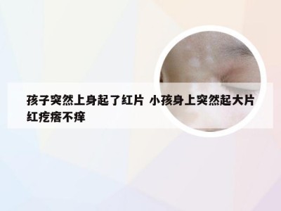 孩子突然上身起了红片 小孩身上突然起大片红疙瘩不痒