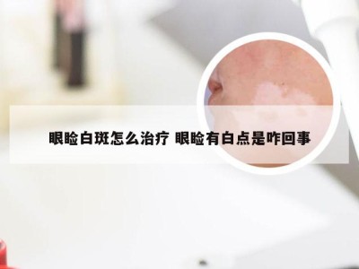 眼睑白斑怎么治疗 眼睑有白点是咋回事