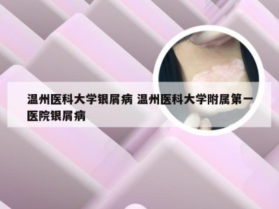 温州医科大学银屑病 温州医科大学附属第一医院银屑病