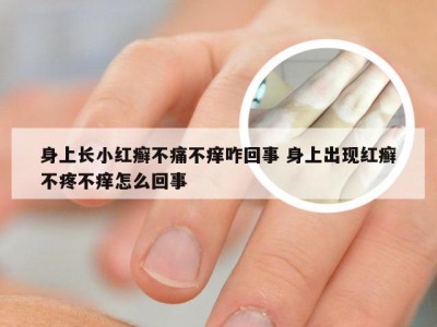 身上长小红癣不痛不痒咋回事 身上出现红癣不疼不痒怎么回事