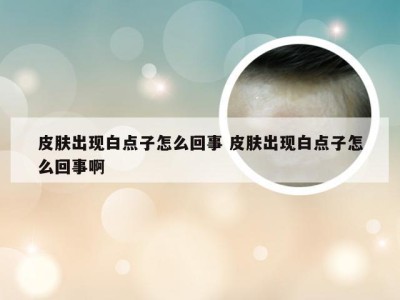 皮肤出现白点子怎么回事 皮肤出现白点子怎么回事啊