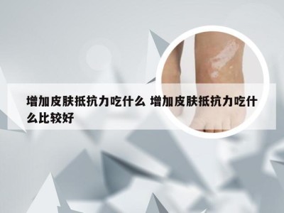 增加皮肤抵抗力吃什么 增加皮肤抵抗力吃什么比较好