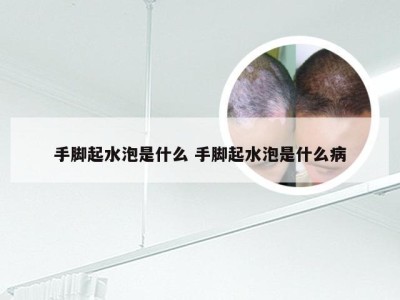 手脚起水泡是什么 手脚起水泡是什么病