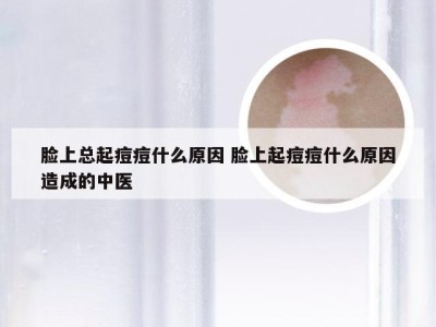 脸上总起痘痘什么原因 脸上起痘痘什么原因造成的中医