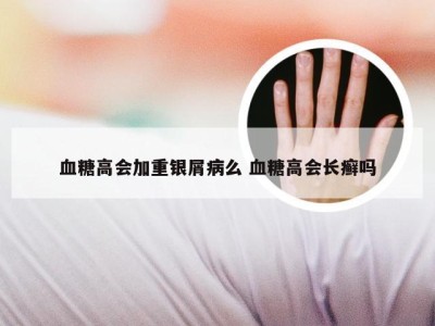 血糖高会加重银屑病么 血糖高会长癣吗