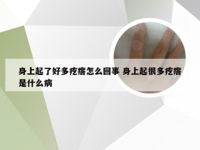 身上起了好多疙瘩怎么回事 身上起很多疙瘩是什么病