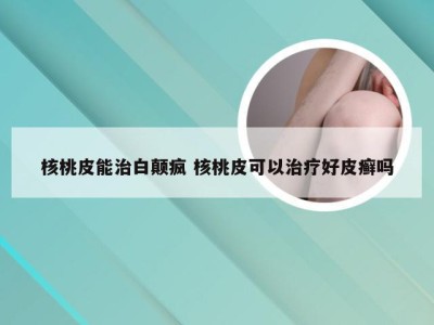 核桃皮能治白颠疯 核桃皮可以治疗好皮癣吗