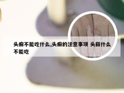 头癣不能吃什么,头癣的注意事项 头藓什么不能吃