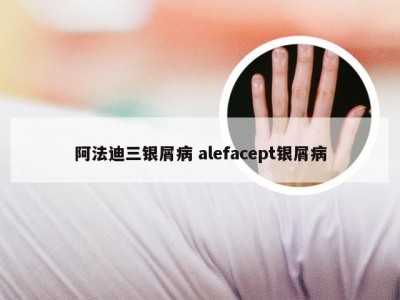 阿法迪三银屑病 alefacept银屑病